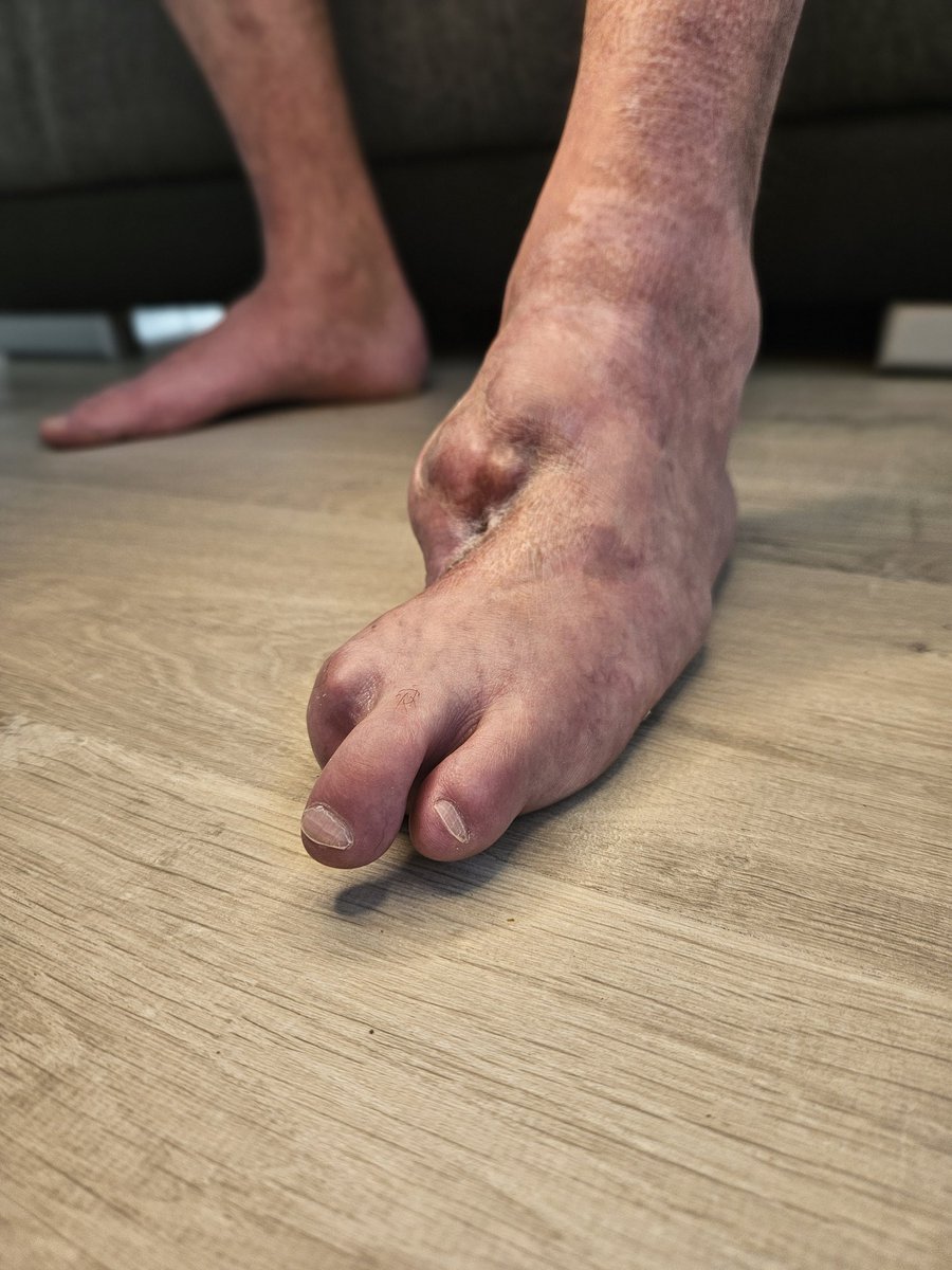 halffoodhero's tweet photo. Ganz exklusive Einblicke in meine Welt und noch mehr Details zu meinen Füßen findet ihr hier... 👣✨ Ich freue mich auf euch!
​Hier geht's lang: https://t.co/gW270NP9eE

​#OnlyFans #FootFetish #LimbDifference #Soles https://t.co/EcQw1yDPjg