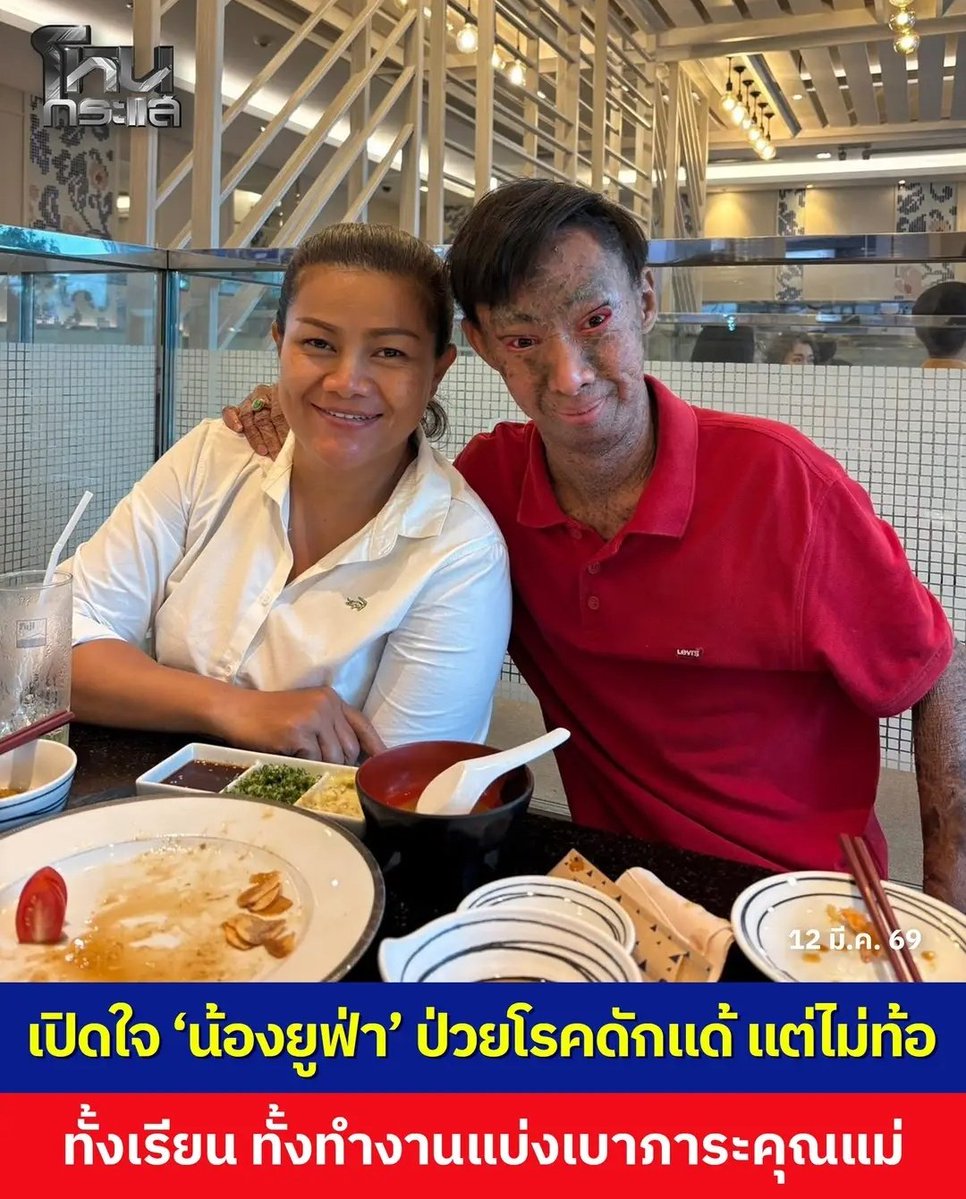 มึง เด็กคนนี้ สมควรได้รับการชื่นชม ไม่ยอมแพ้ต่ออุปสรรค ขยันทำงานตั้งใจเรียน ขอให้น้องได้รับสิ่งที่ดีๆ เข้ามาในชีวิตนะครับ สุดยอดมากจริงๆ!!!!!
#โหนกระแส