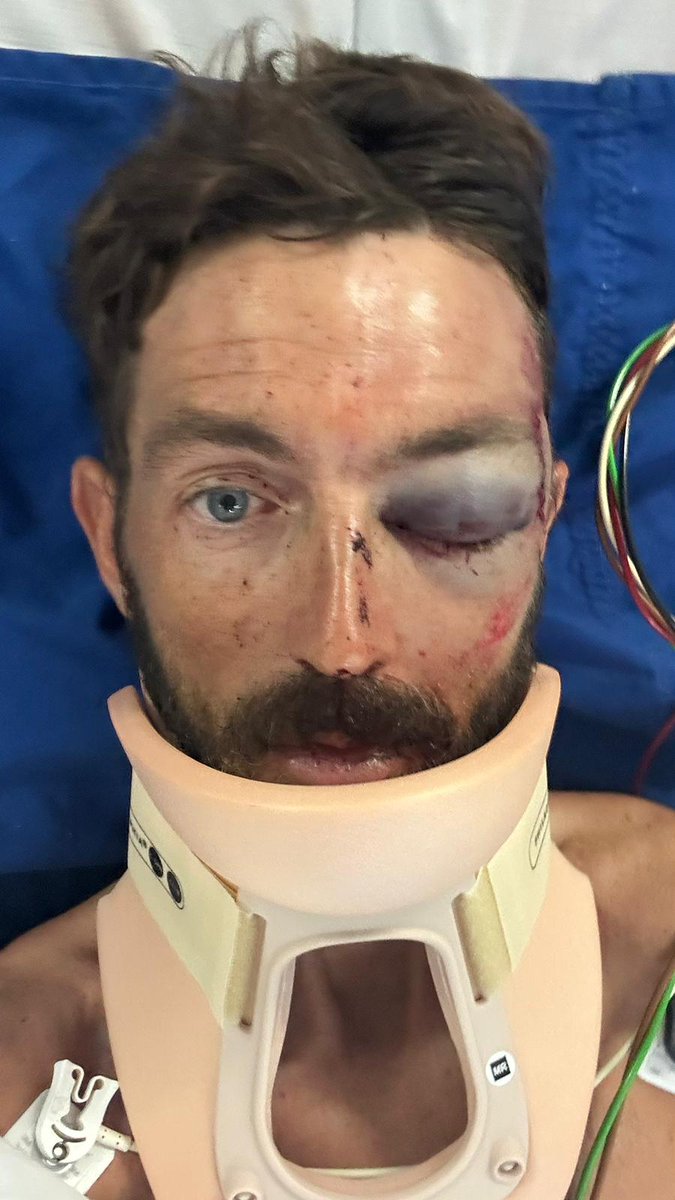 Nick Squillari tweet media