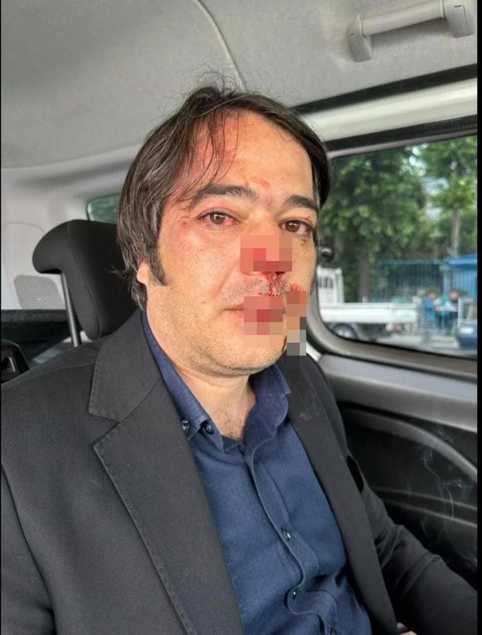 KIZININ İLK KEZ “BABA” DEDİĞİNİ MAHKEMEDE ÖĞRENDİ

Salacak sahilini işgallerden temizledi.

Bu yüzden saldırıya uğradı, hastanelik oldu ama geri adım atmadı. Sahili halka açtı.

Ramazan Gülten İmar Daire Başkanıydı ama 
güneş görmeyen giriş katta, krediyle alınmış mütevazı bir