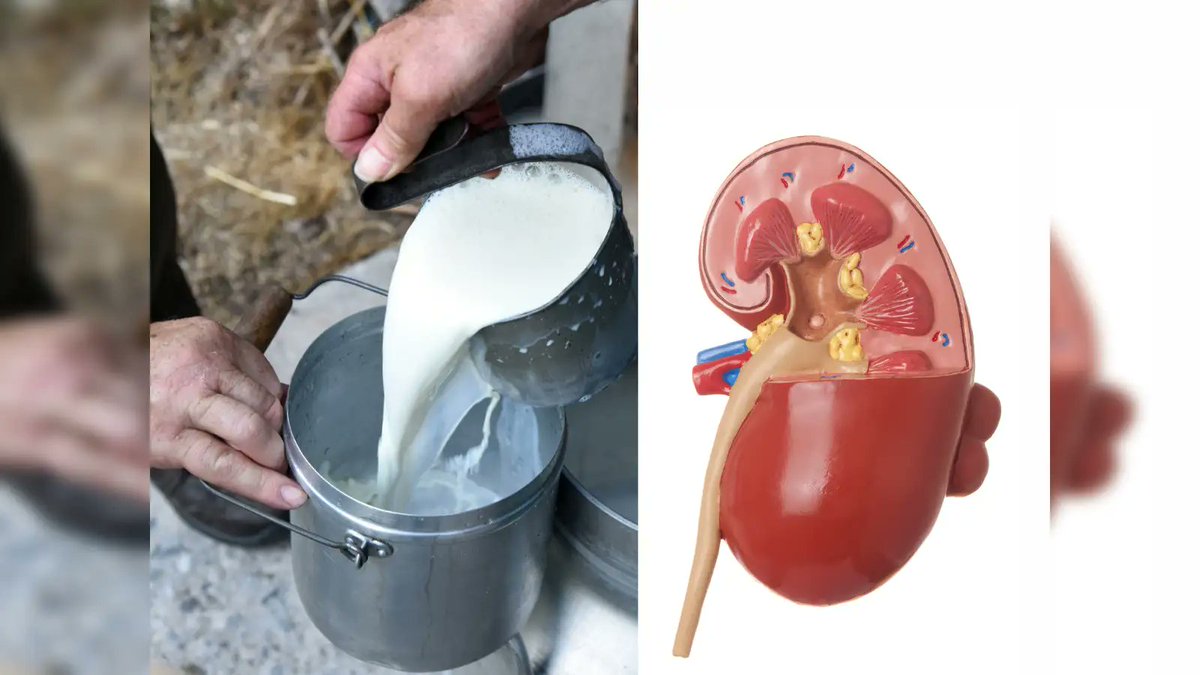 Delhiite_'s tweet photo. 13 people dead after drinking "Milk" in Andhra Pradesh.

Turns out it wasn't milk… it was a chemistry experiment (adulterated) by vendor Addala Ganeswararao.
- 11 people still hospitalised with kidney failure. Those 13 died also from kidney failure.

Food safety in India: Pray before drinking milk, water or even breathing. Quality control apparently runs on “Bhagwan bharose.”💀