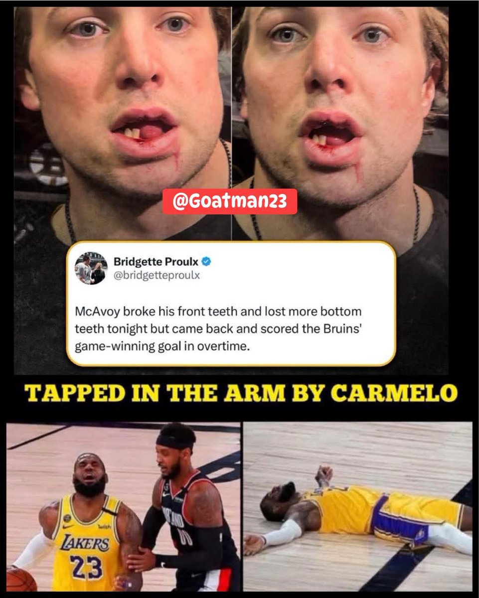 Goatmanx23's tweet photo. LeBron is by far the softest player in sports history 💯💯 #LeSoft #LeTrash #LeChoke #LeDiddy https://t.co/7cbJegZgzP