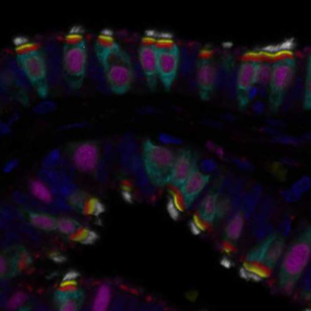 Human Protein Atlas tweet media