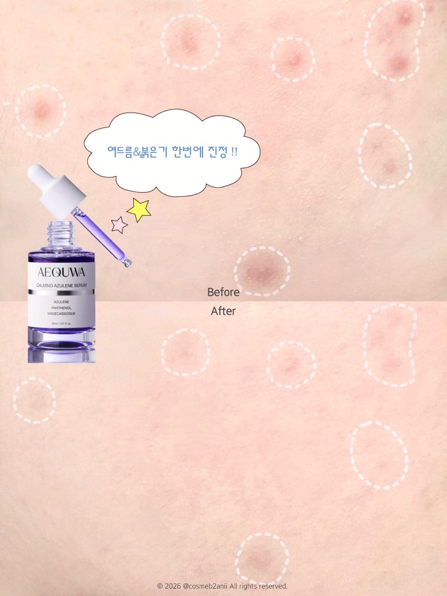 #광고 <a href="/aequwa/">에쿠와</a>  
#RT이벤트 에쿠와 카밍 아줄렌 세럼 / 토너 택1 (10인)

민감성 수부지로 nn년 살면서  
진정 + 속건조 둘 다 잡는 기초 처음 봄…

3일만 써도 붉은기 진정 효과가 확실해서 너무 좋았고  
며칠 동안 안 없어지던 붉은 염증성 여드름이랑 요철도  
에쿠와 토너 + 아줄렌 세럼으로