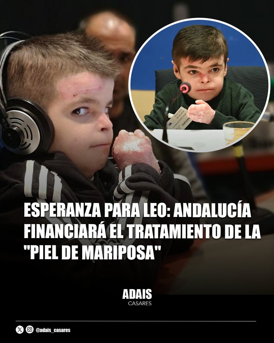 Esperanza para Leo. 

La Junta de Andalucia ha anunciado este jueves que el Servicio Andaluz de Salud asumirá de forma excepcional el coste del medicamento Vyjuvek para Leo y otros 45 pacientes andaluces afectados por la epidermólisis bullosa distrófica.

El tratamiento asciende