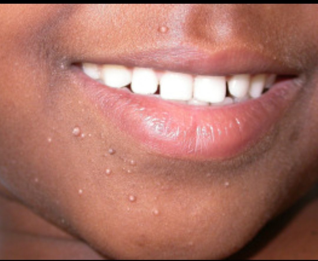 Haji Siyamuddin ANSARI tweet media