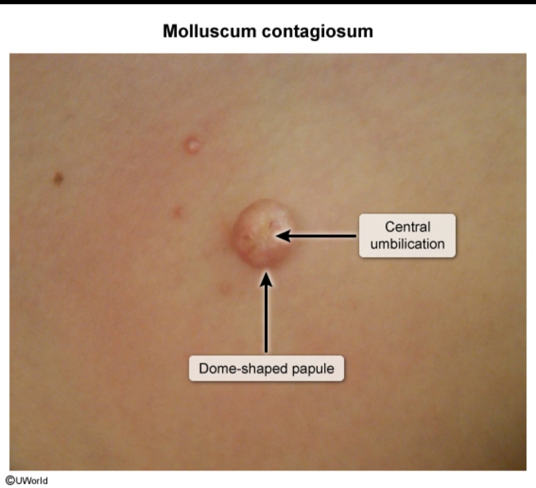 Haji Siyamuddin ANSARI tweet media