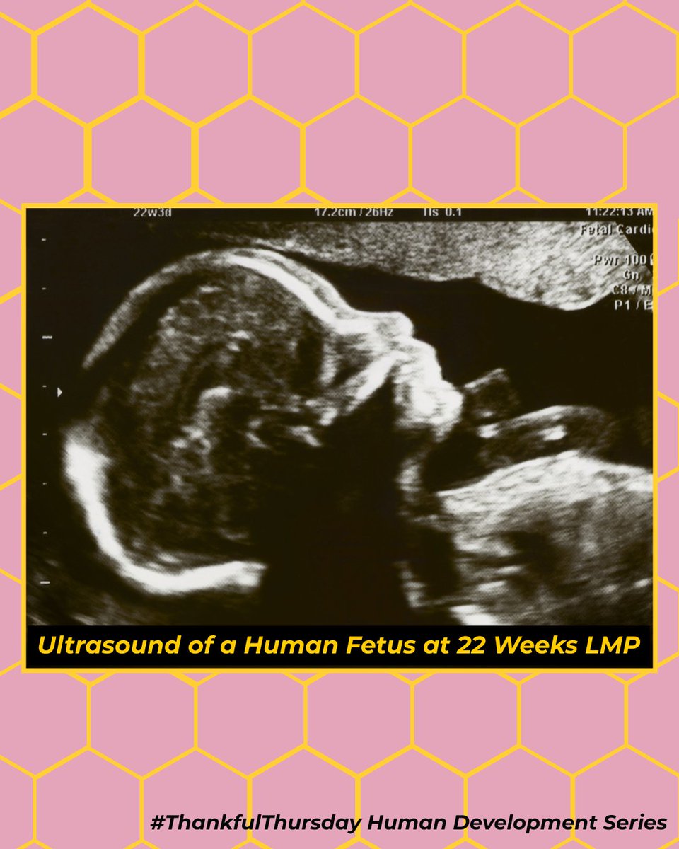 Pro-Life Wisconsin tweet media