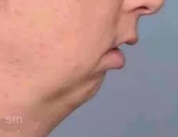 MRT 💹🧲 tweet media