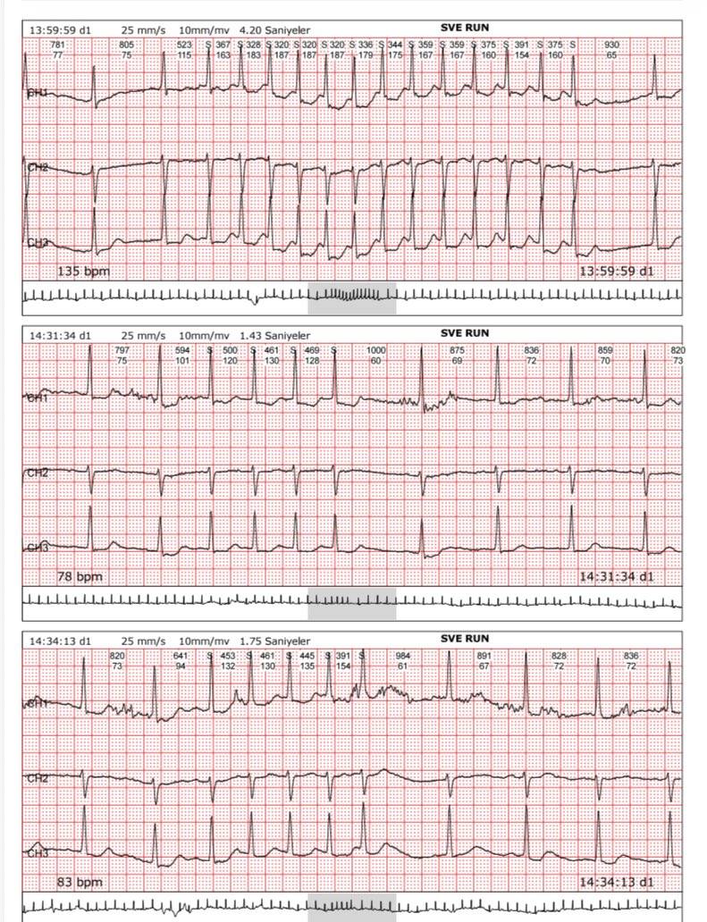 Oktay Gülcü ,MD tweet media