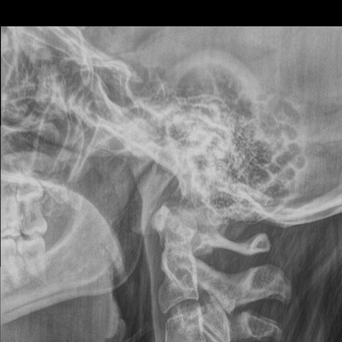 Groteskox tweet media