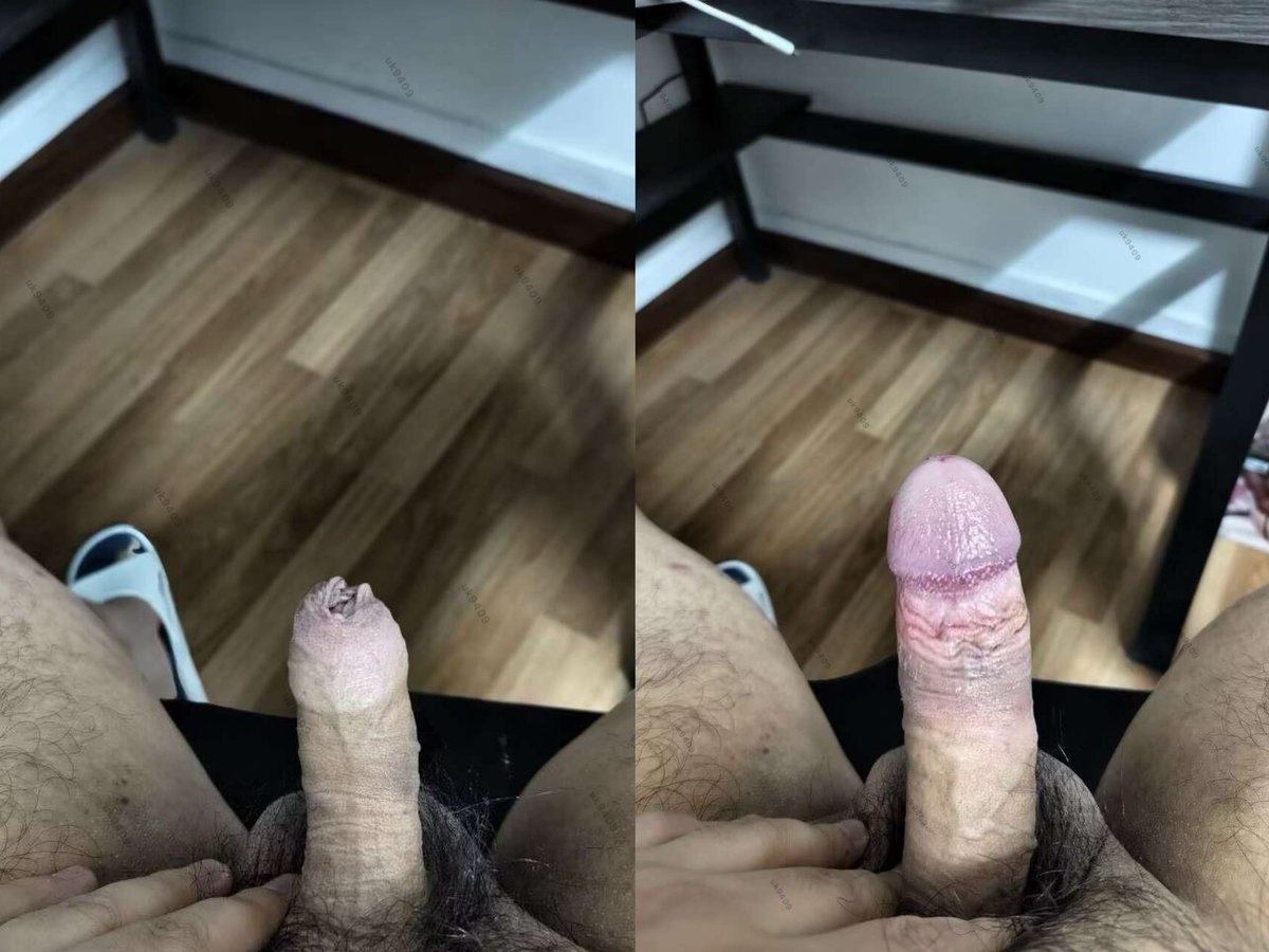 一丝不苟-男性健康 tweet media