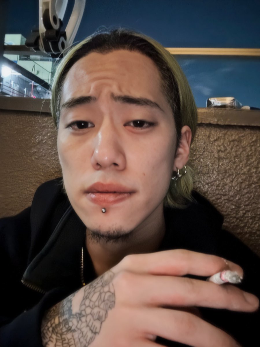 左目が腫れてる