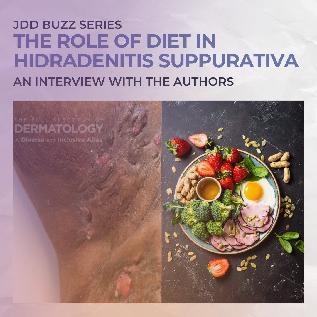 SkinOfColorDerm's tweet photo. Can diet make a difference in hidradenitis suppurativa? 

Emerging research suggests it can: https://t.co/c11evfIMk3

#HidradenitisSuppurativa #HS #ChronicDiseaseManagement #DermResearch https://t.co/u8YxJg8P9u