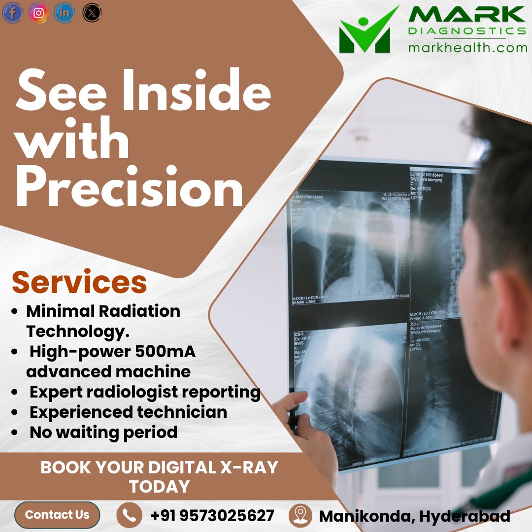 MarkDiagnostics's tweet image. See Inside with Precision.
Advanced Digital X-Ray with minimal radiation, expert reporting, and no waiting period at Mark Diagnostics.
📍 Manikonda, Hyderabad
📞 +91 9573025627

#MarkDiagnostics #DigitalXray #Healthcare #Diagnosticsnearme #Manikonda #Hyderabad