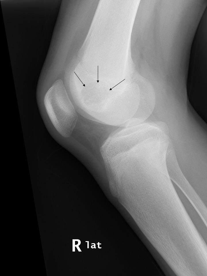 Charlie Herndon tweet media