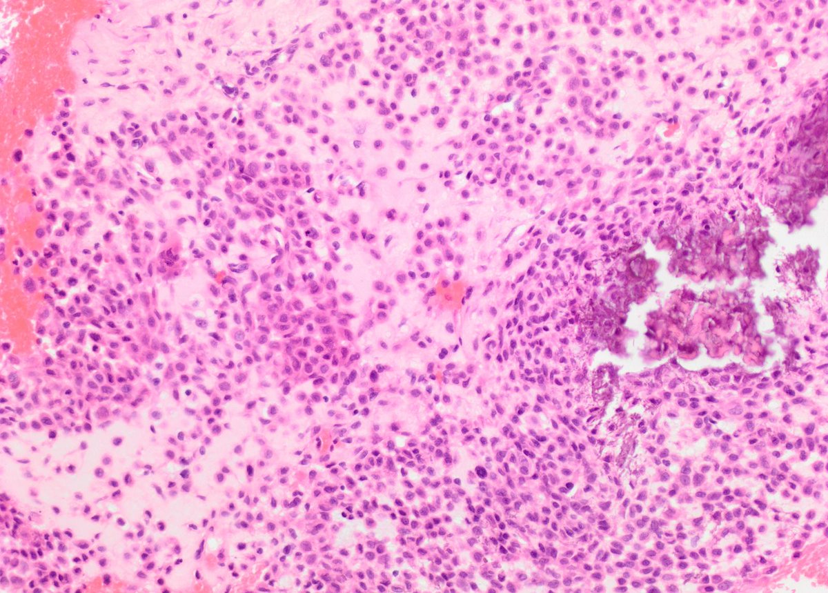 Charlie Herndon tweet media