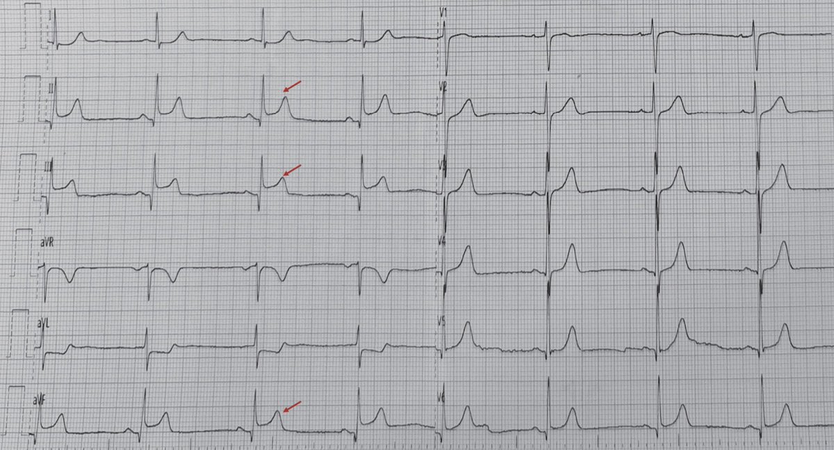 European Society of Cardiology Journals tweet media