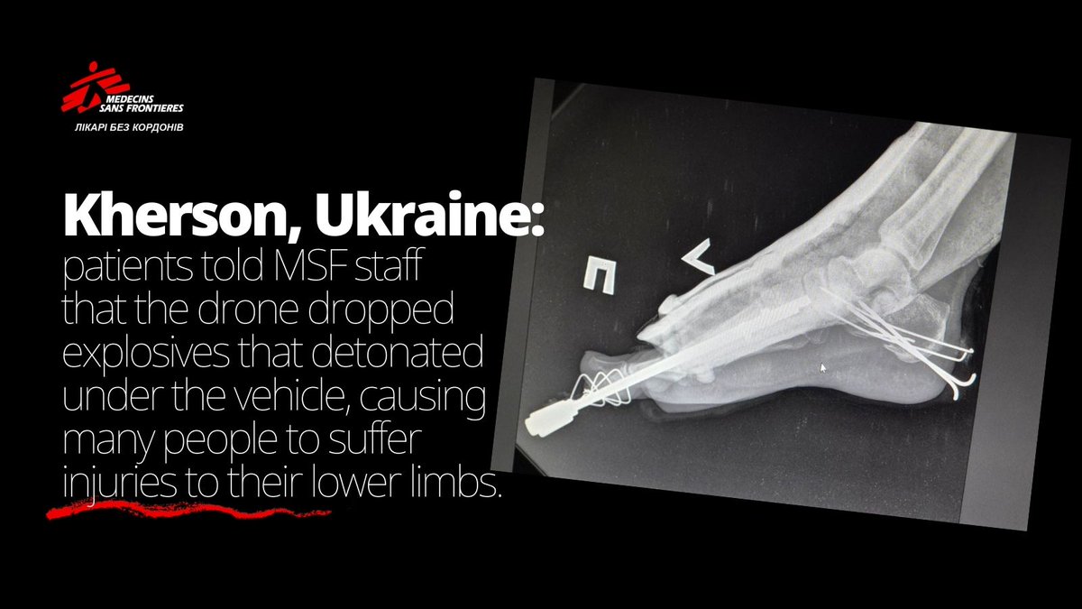 MSF Ukraine tweet media