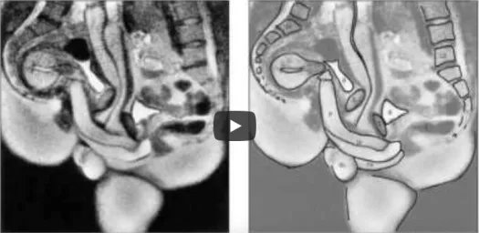 Marc Gozlan tweet media