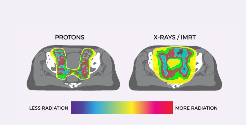 ProCure Proton Therapy Center tweet media