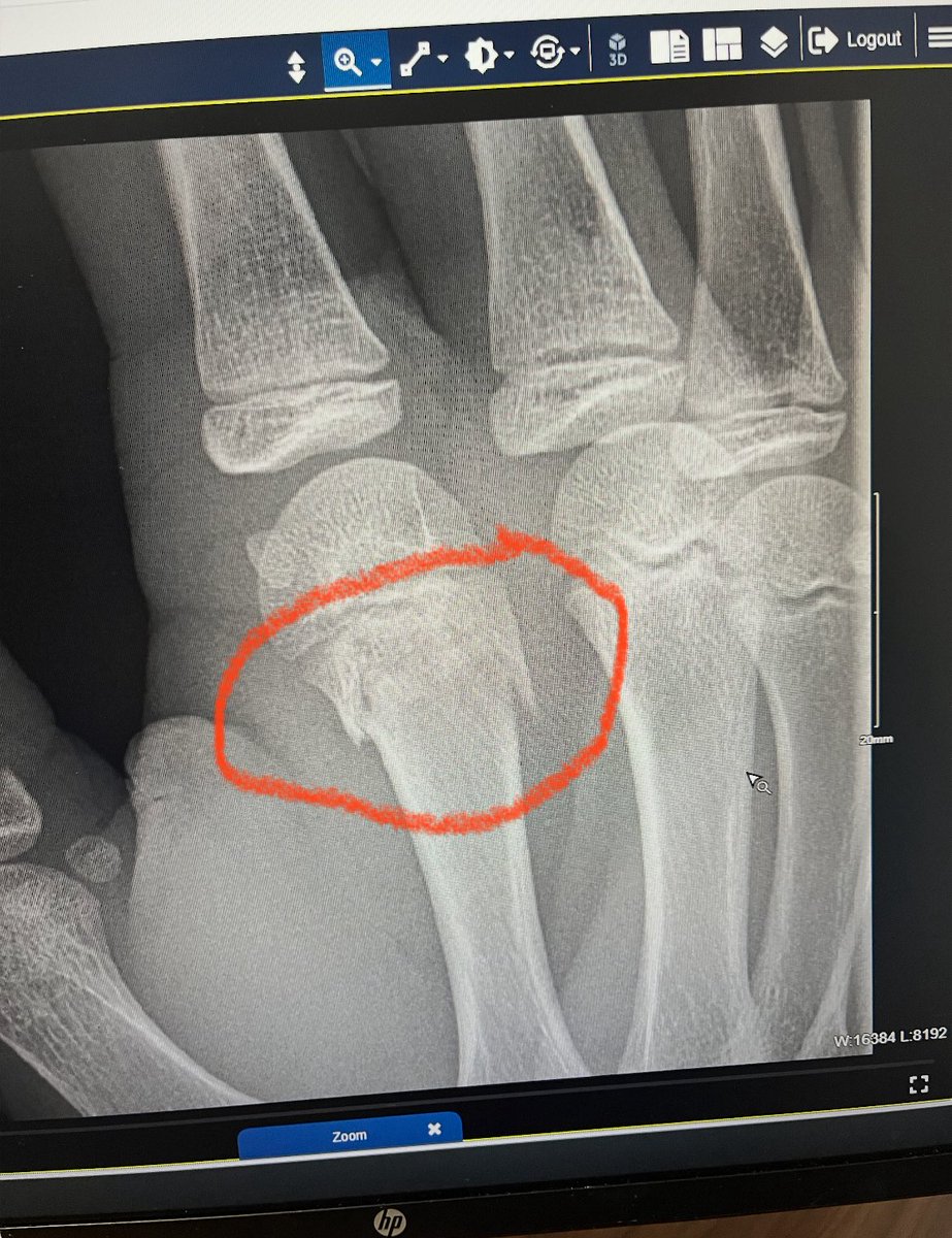 Hunterlovesmetal tweet media