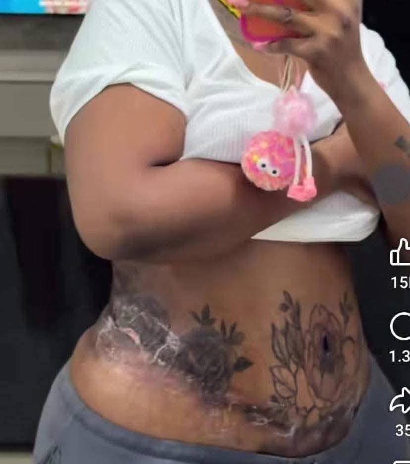 PeePee🎀 tweet media