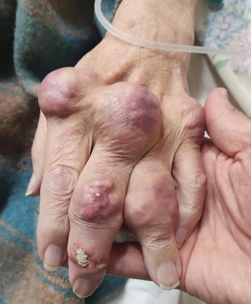 Mastering the Differential 🩺 tweet media