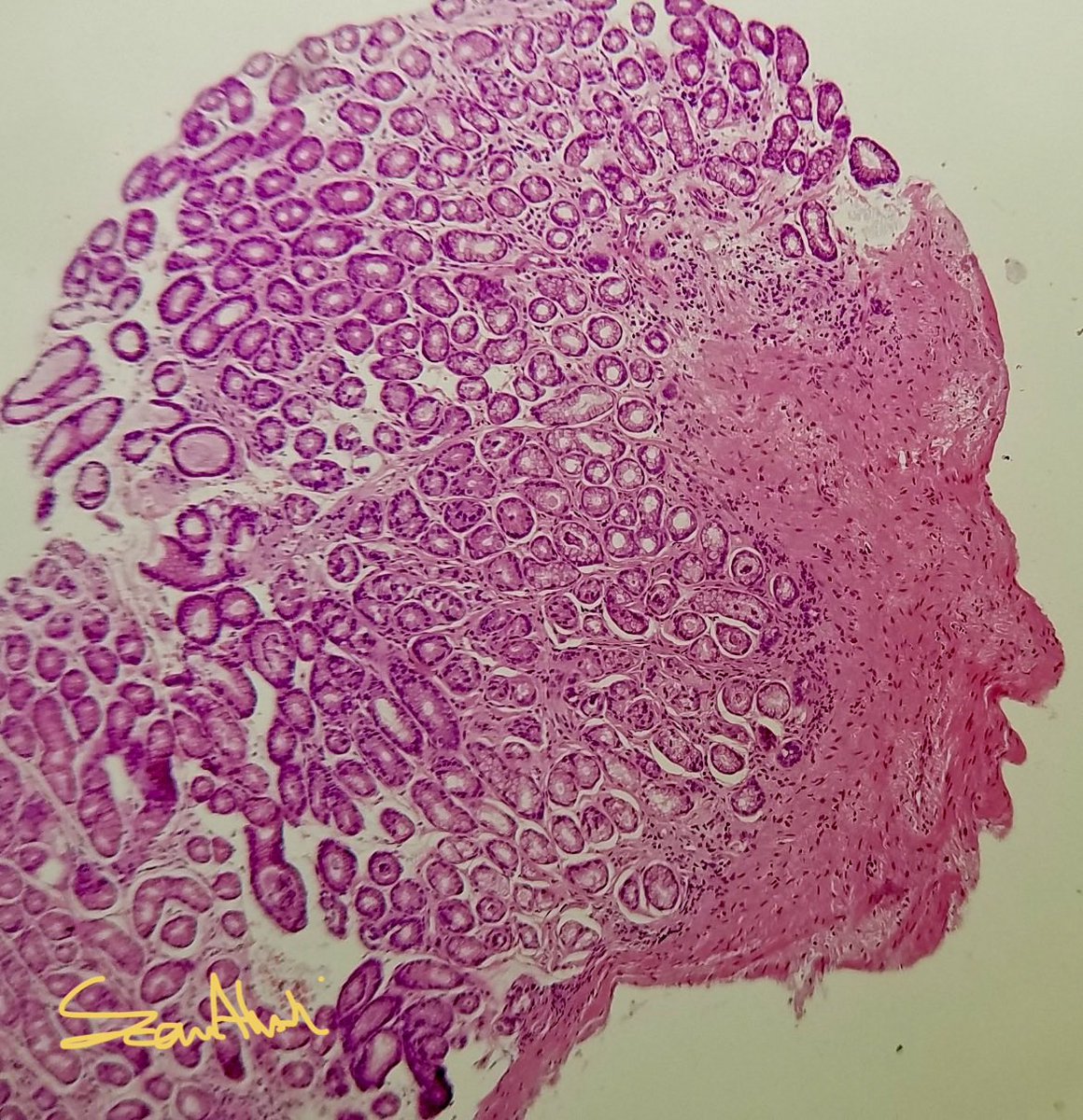 Sam Albadri, M.D., M.Sc. tweet media