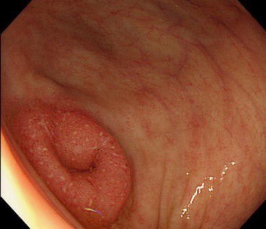 Keith Siau tweet media