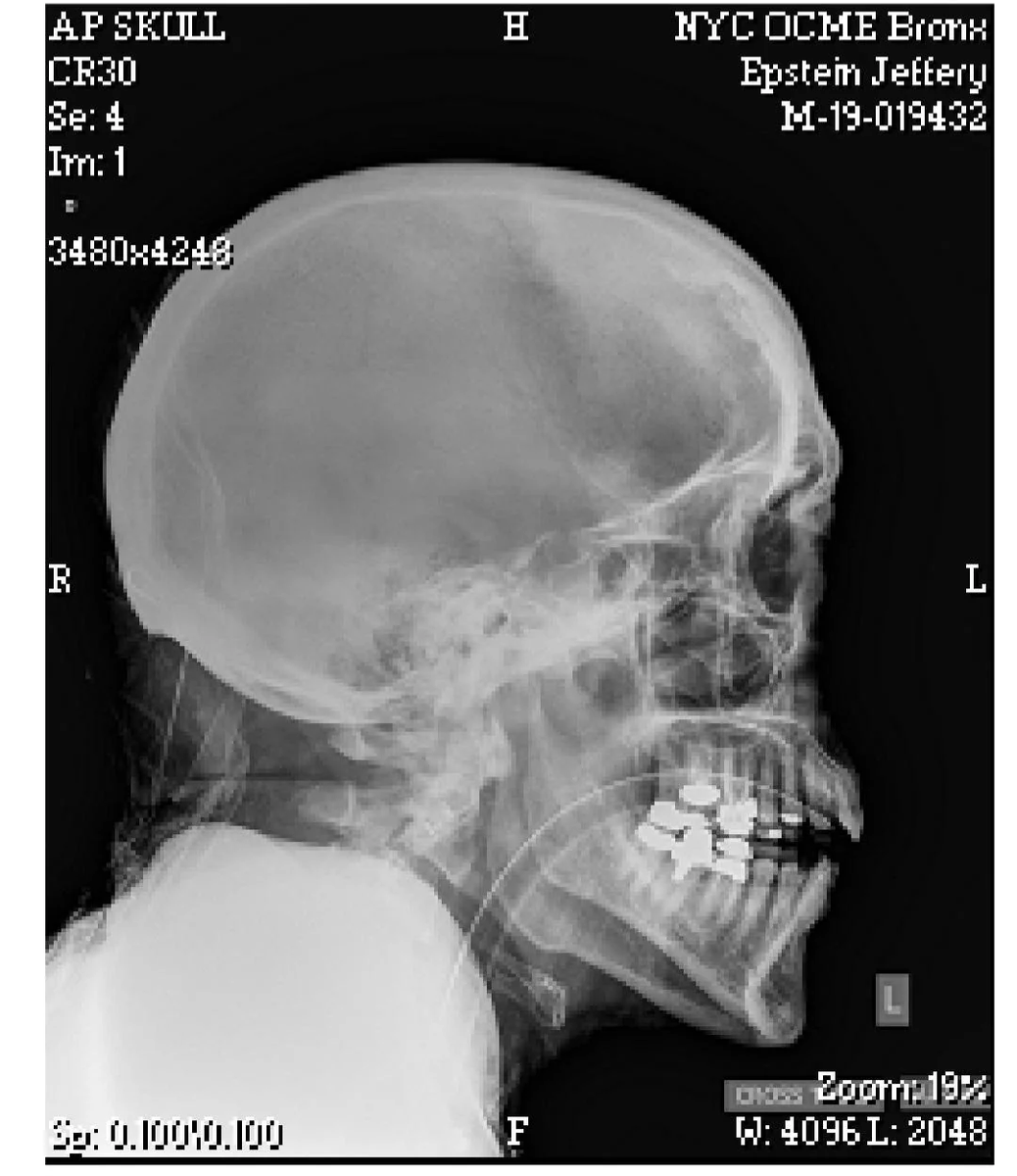 Boston Smalls tweet media