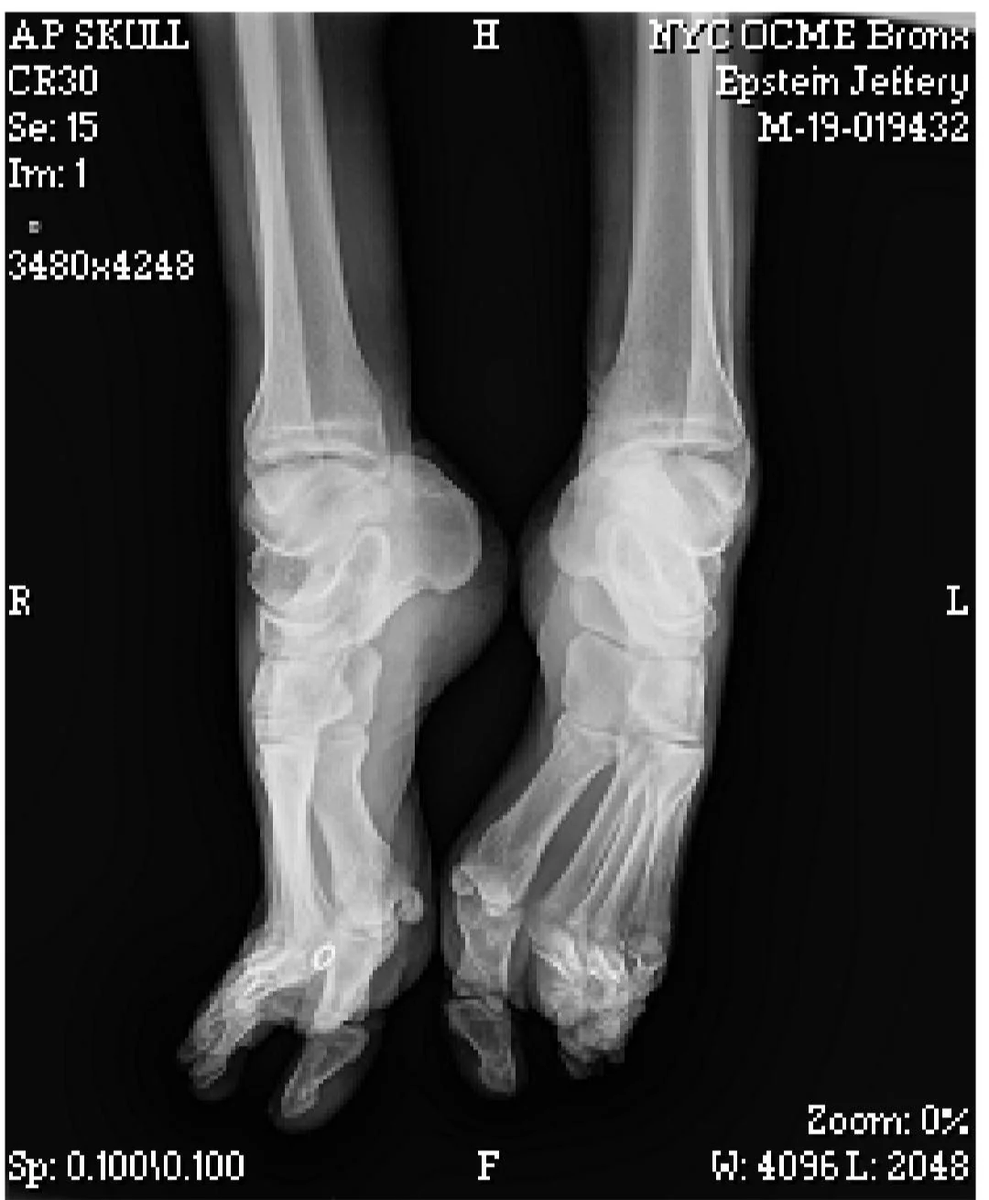 Boston Smalls tweet media