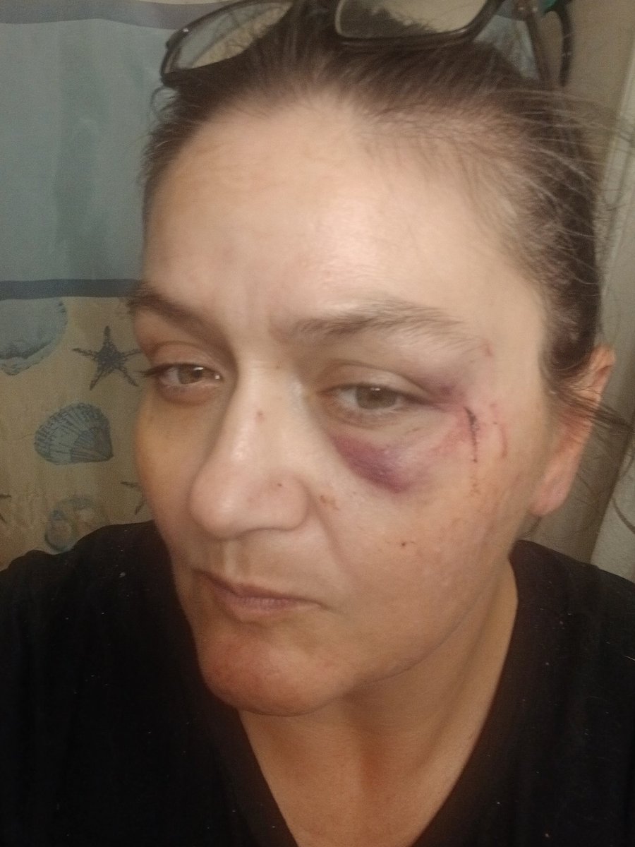 XCyberSecure's tweet photo. This is what it looks like to be a survivor on the streets when the code is: you don't call the law or you put you and your family in danger. All the prison gangs get really tight with all the time they have on their hands... clapping for Texas... what do you do to help??? https://t.co/YdkRFXkUZm