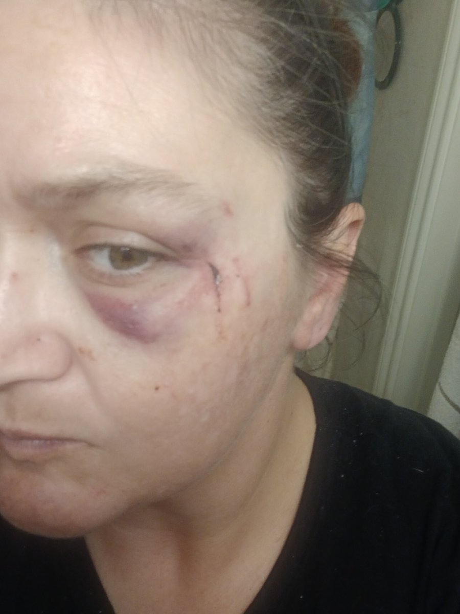 XCyberSecure's tweet photo. This is what it looks like to be a survivor on the streets when the code is: you don't call the law or you put you and your family in danger. All the prison gangs get really tight with all the time they have on their hands... clapping for Texas... what do you do to help??? https://t.co/YdkRFXkUZm
