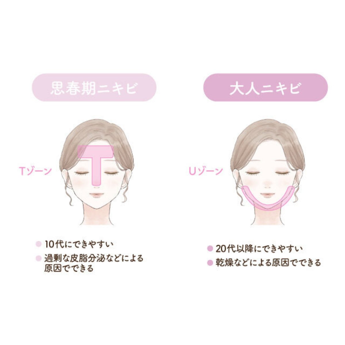 RAXYBeautyBox's tweet photo. ＼ 新生活までに肌を整えたい人集合 ／
思春期・大人ニキビ、それぞれの原因に合わせた《神洗顔》10選を紹介！

ドラストで買えるプチプラ商品多数ご紹介👛
自分に合うケア、記事で確認してみてね👇
https://t.co/wWTSTFbpxE https://t.co/BSwMV8YQgn