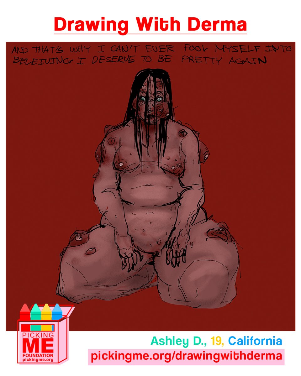 Picking Me Foundation #dermatillomania tweet media
