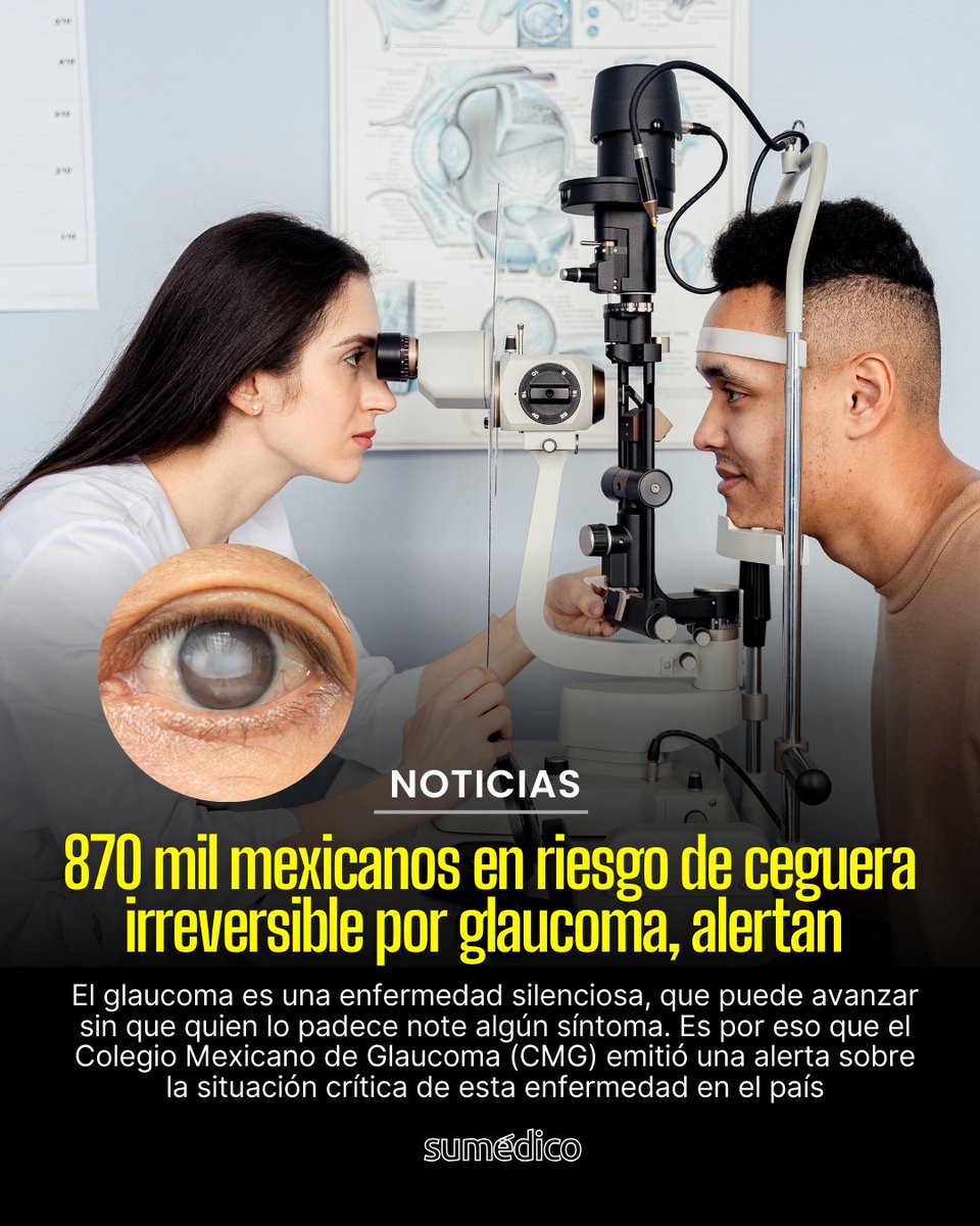 sumedico's tweet image. 👁️⚠️ El #Glaucoma puede causar ceguera irreversible y muchas personas no saben que lo padecen.

El @CMGlaucomamx  alerta que 870 mil personas en México están en riesgo.

La enfermedad daña el nervio óptico y es una de las principales causas de ceguera en mayores de 60 años.

Link
