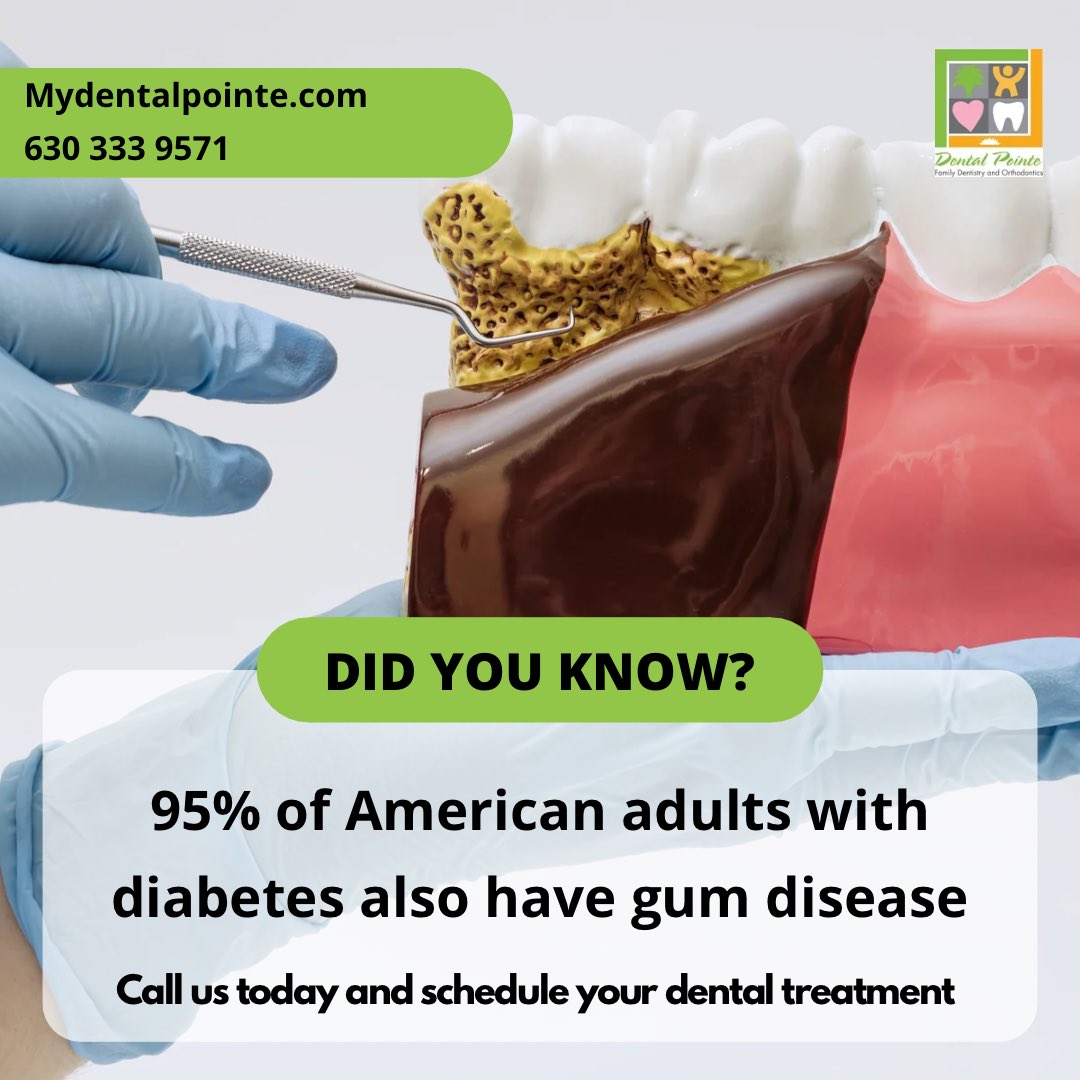 People with diabetes usually have gum disease. This can result in loose teeth and eventual tooth loss. Gum disease can be managed with visits to the dentist every 3 months and with good oral hygiene habits. #dentalpointe #napervilledentist #auroradentist #warrenvilledentist