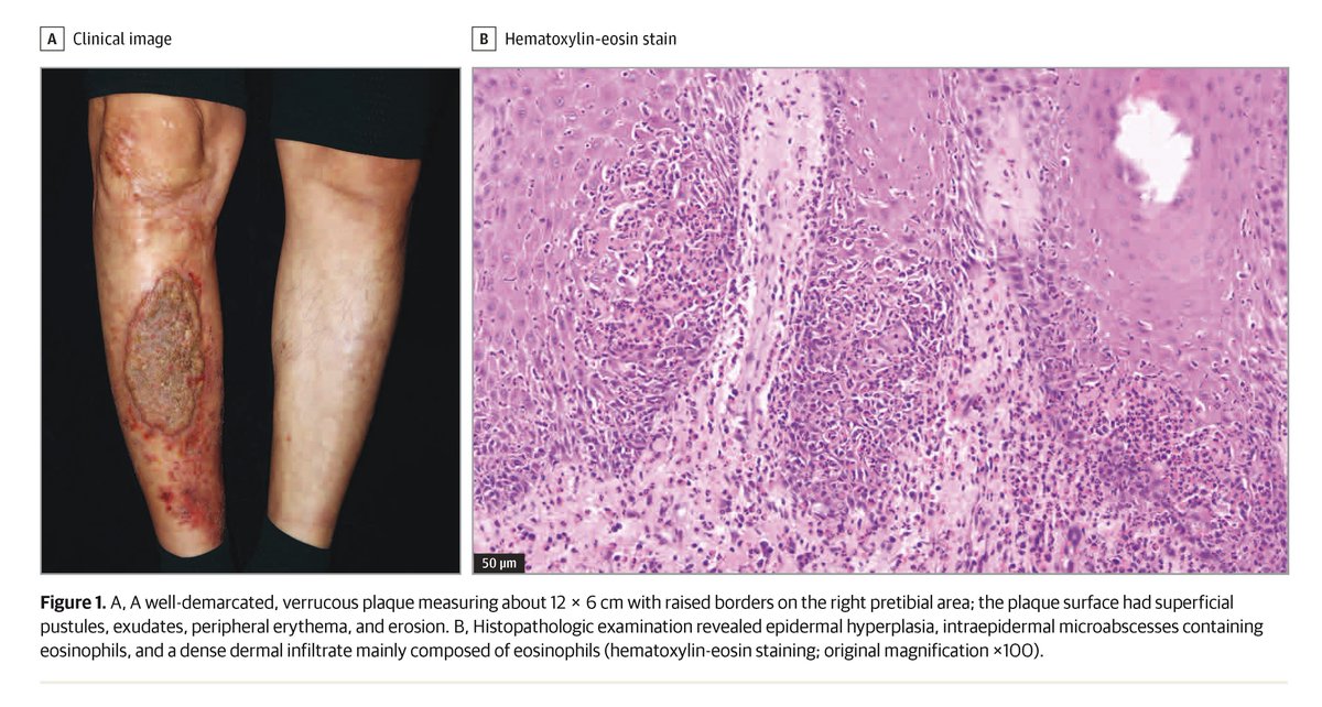 JAMA Dermatology tweet media