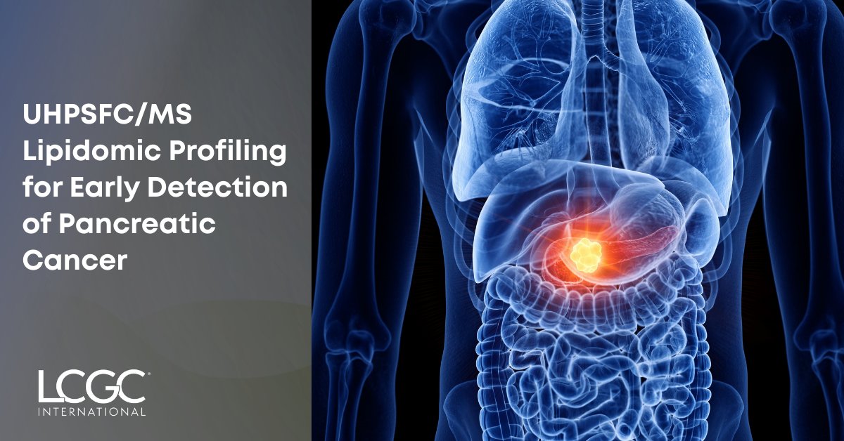 LCGC International tweet media