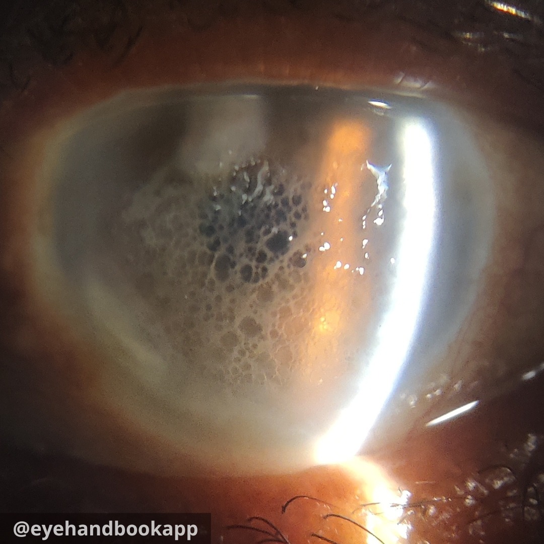 Eye Handbook tweet media