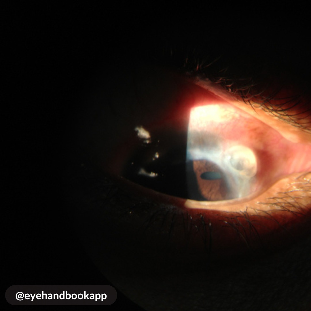 Eye Handbook tweet media