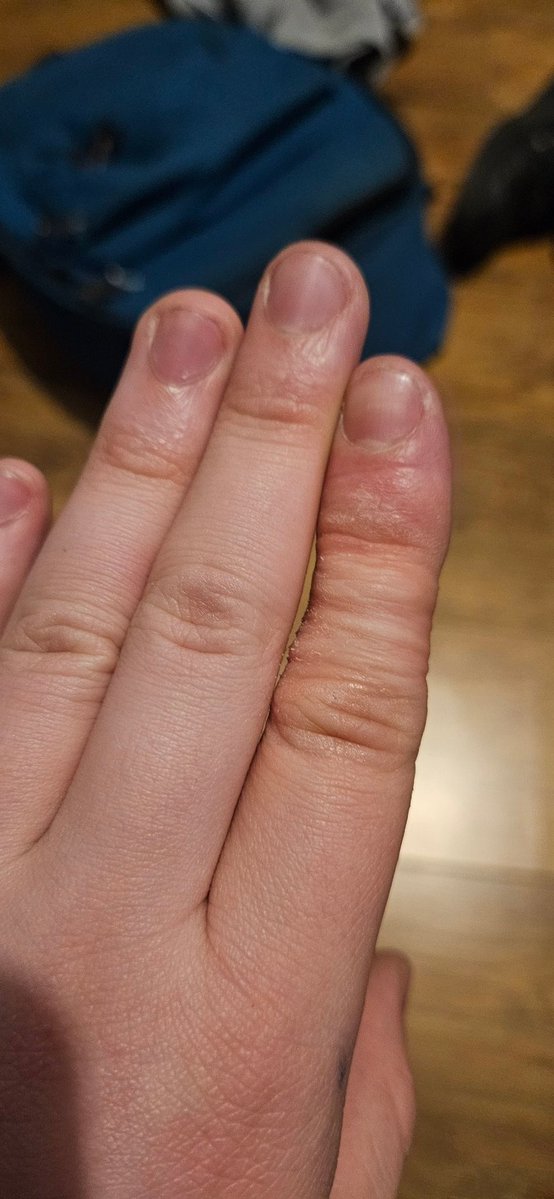 lezko🖊 tweet media