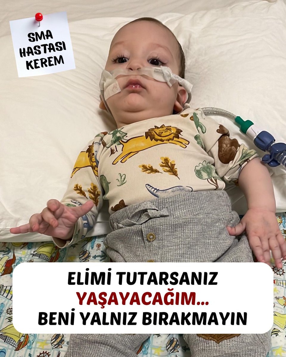 smaazemyildirim's tweet photo. Fitre Fidye Zekâtlarınız ve İyilik Bağışlarınız  Kerem'e nefes olsun‼️ 
Sma değil Kerem bebek KAZANSIN ‼️

Hayırlı Cumalar Çatlı #Bist100Tavan
#PoliseMesaiÜcretiVerin
#SAMvRAYO Ekrem 
Uğurcan Çakır  #UECL 
Şampiyonlar Ligi'nde 
Başakşehir Milano Avrupa https://t.co/wxeMgEPOHN