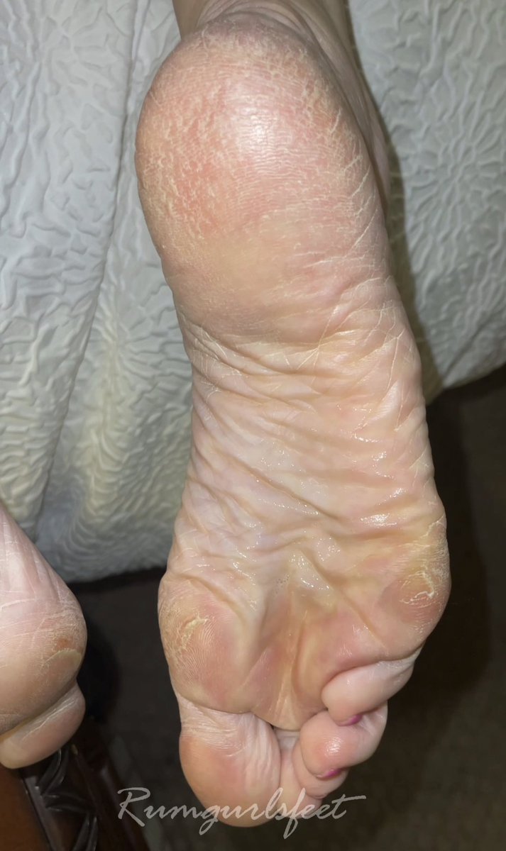 rumgurlsfeet tweet media