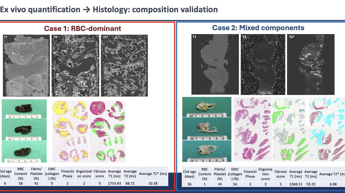 Trisha L. Roy MD PhD FACS tweet media