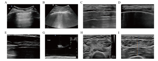 RespiratoryBMC's tweet image. 📕Article Alert 📕

Interpretable machine learning model based on multimodal ultrasound for bedside diagnosis of acute exacerbations in COPD
#OpenAccess #Machine #RespiratoryResearch

Read the article: doi.org/10.1186/s12931…