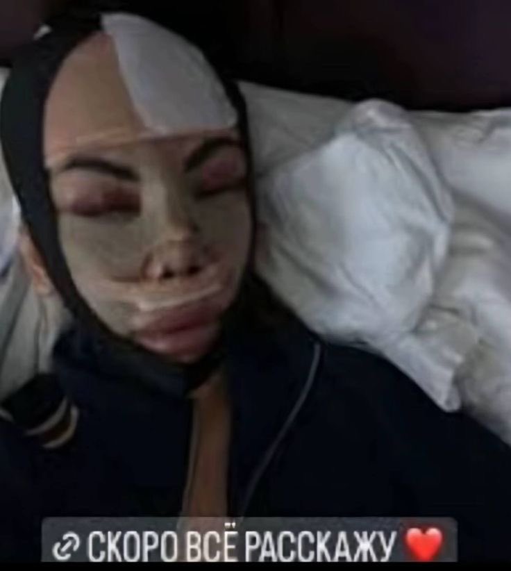p’yorrie🪰ясма tweet media