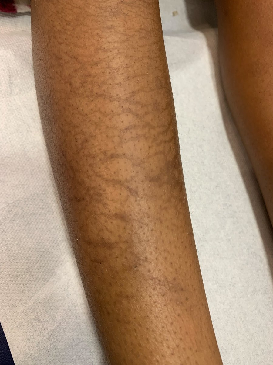 Richard Talbot tweet media