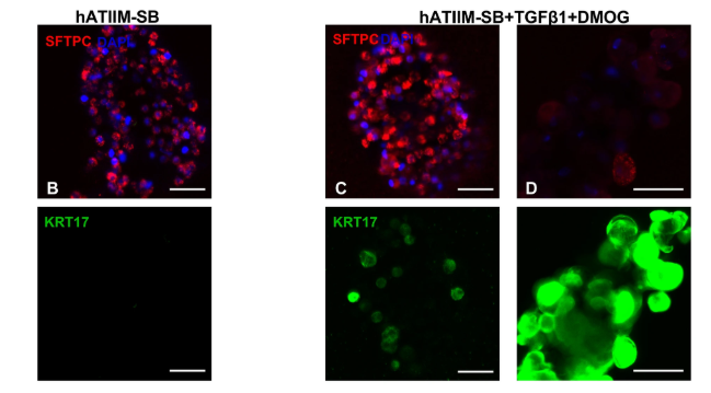 RespiratoryBMC's tweet photo. 📕Article Alert 📕

Modulation of an aberrant basal cell program in human alveolar epithelial spheroids and lung slices
#OpenAccess #Basal #RespiratoryResearch

Read the article: https://t.co/Y1gf6YoZGP https://t.co/cW1HrNoyzi